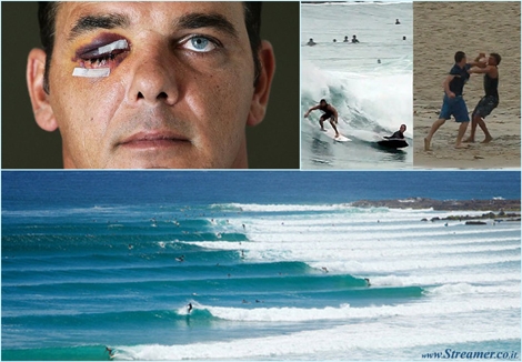 surf rage australia מכות בגלישה אוסטרליה